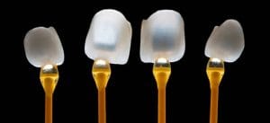 Dental Veneers Types & Procedures in Antalya, Turkey