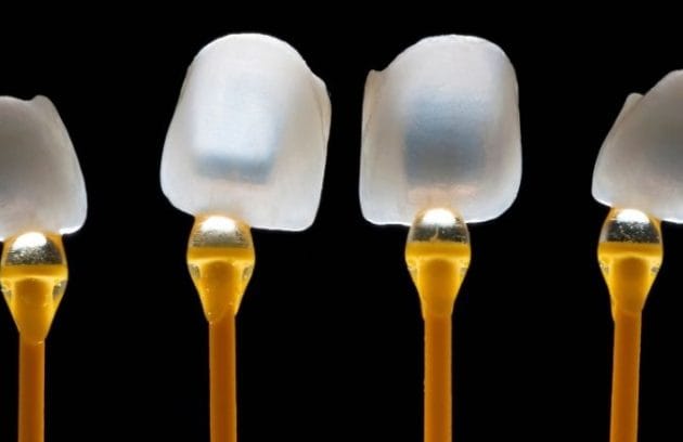 Porcelain dental veneers displayed under light in Antalya, Turkey, showcasing different types of veneers available.