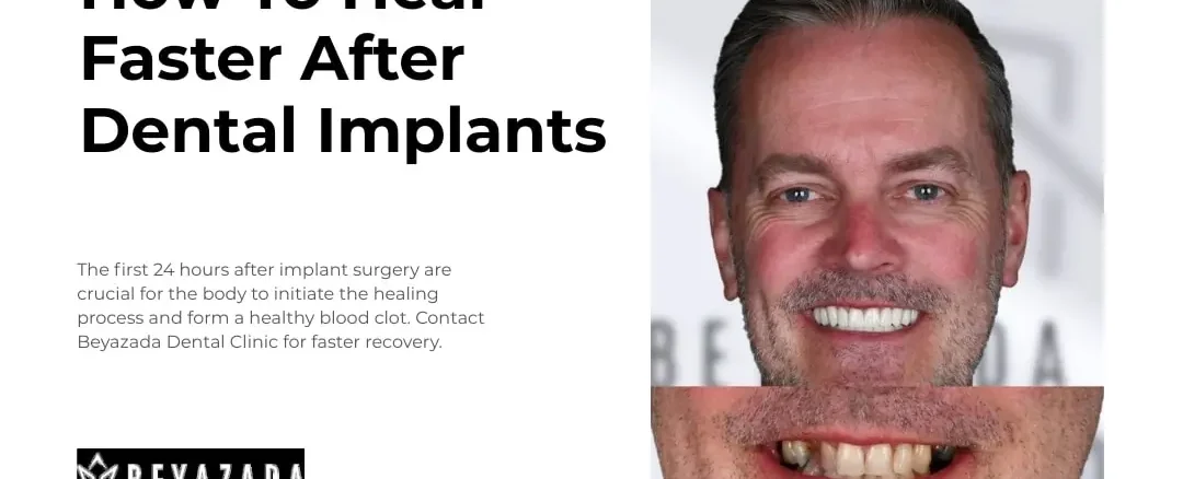 how to heal faster after dental implants