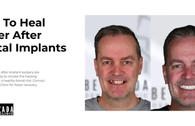 how to heal faster after dental implants turkey