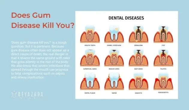 Does gum disease kill you?