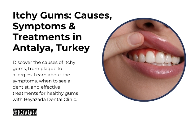 itchy gums antalya turkey